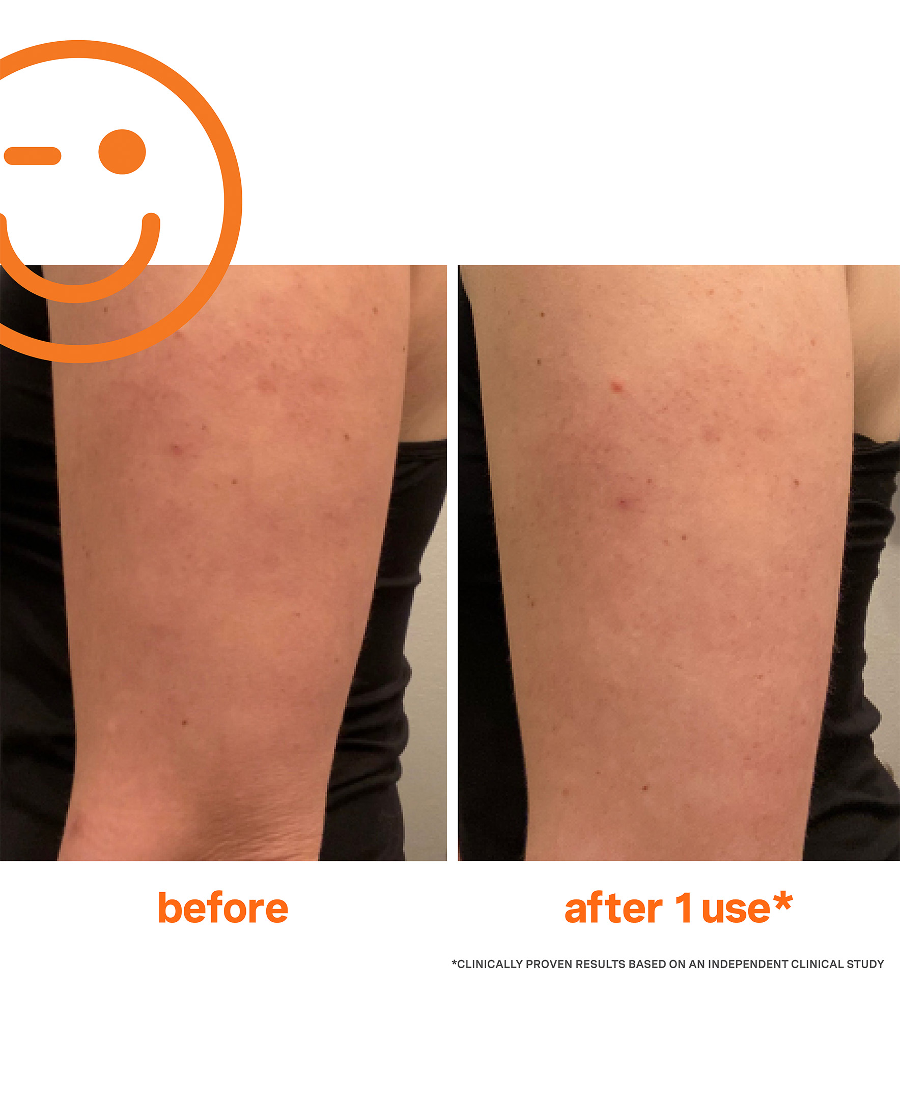 ExfoliKate Resurfacing Body Scrub